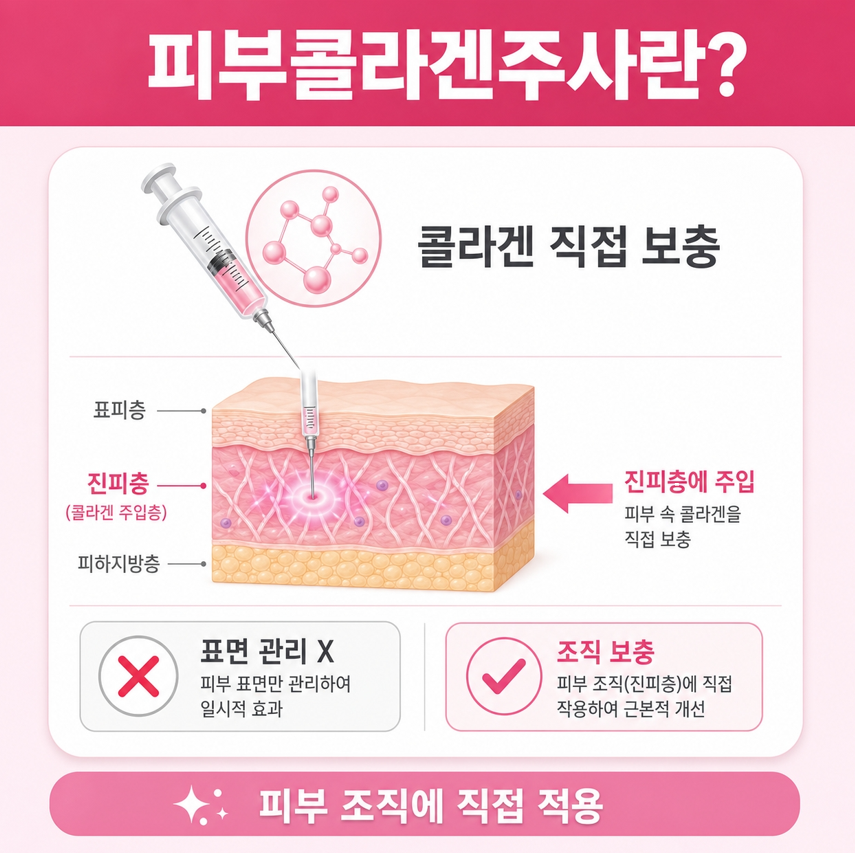 피부콜라겐주사 관련 이미지 6