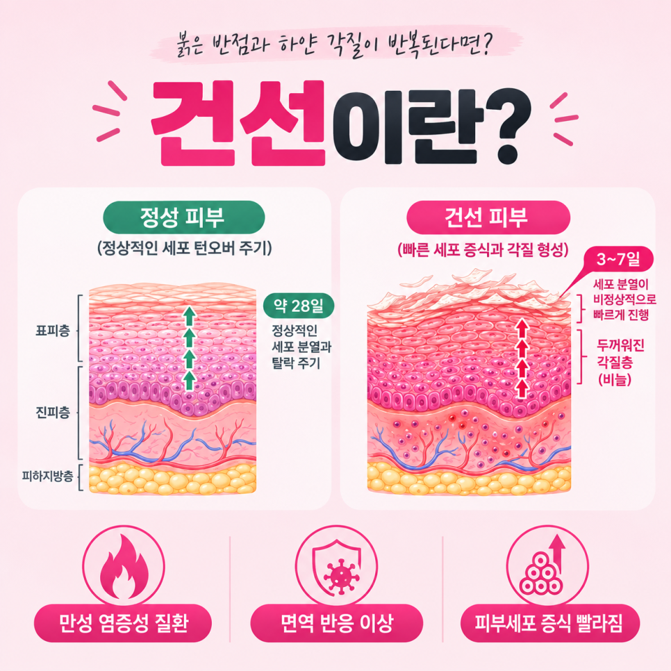 얼굴건선 관련 이미지 3