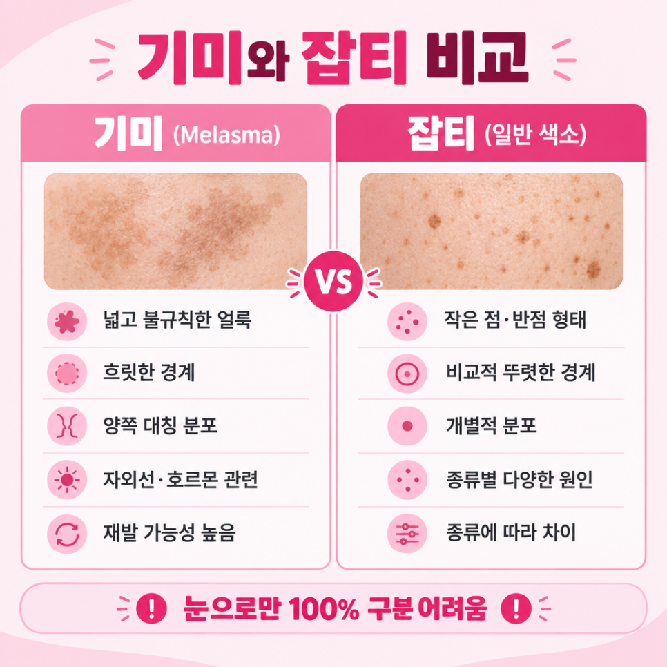 기미없애는법 관련 이미지 5
