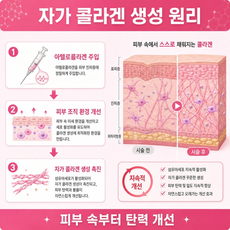 얼굴탄력시술 관련 이미지 6