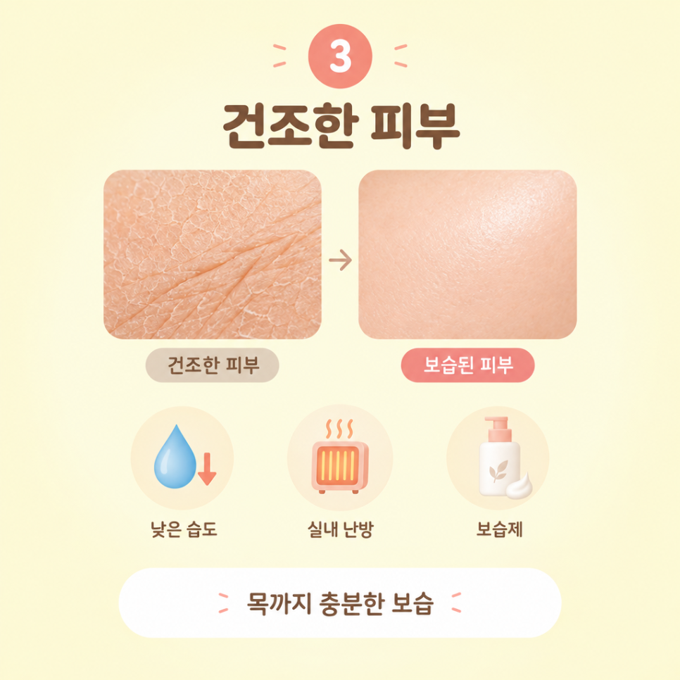 목주름관리법 관련 이미지 6