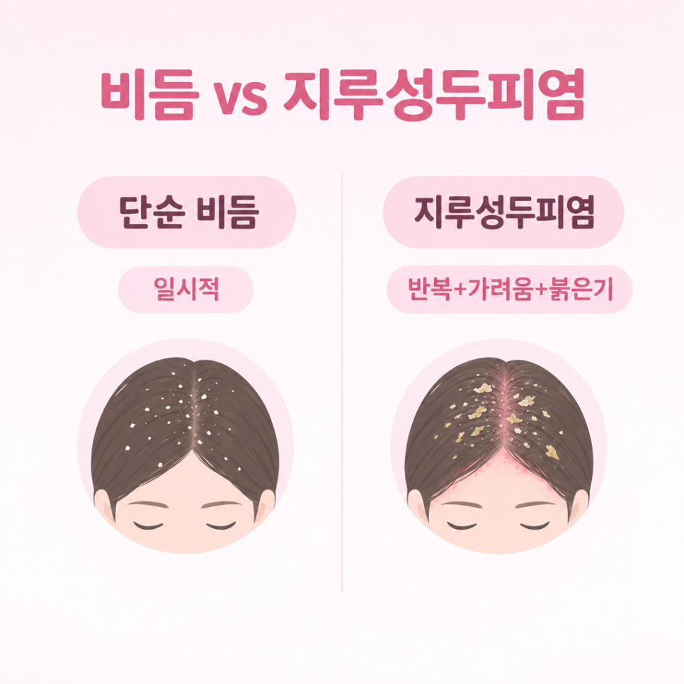 지루성두피염원인 관련 이미지 8